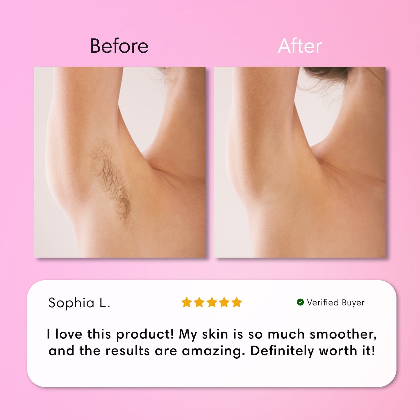 SmoothSkin Hair Removal Cream | Gentle 5-Minute Body Hair Removal
