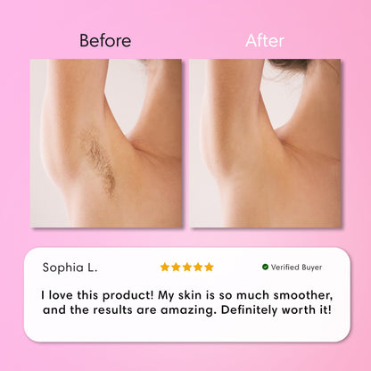 SmoothSkin Hair Removal Cream | Gentle 5-Minute Body Hair Removal