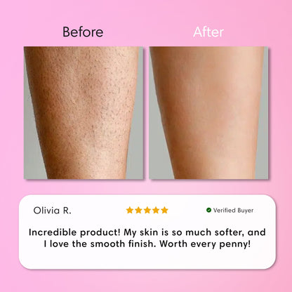 SmoothSkin Hair Removal Cream | Gentle 5-Minute Body Hair Removal