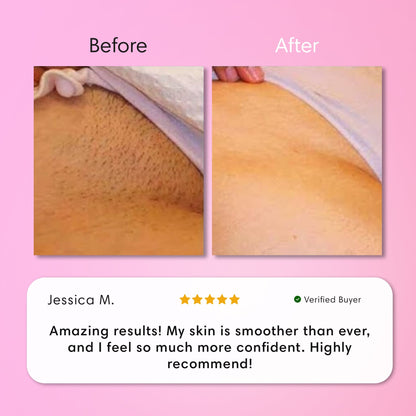 SmoothSkin Hair Removal Cream | Gentle 5-Minute Body Hair Removal