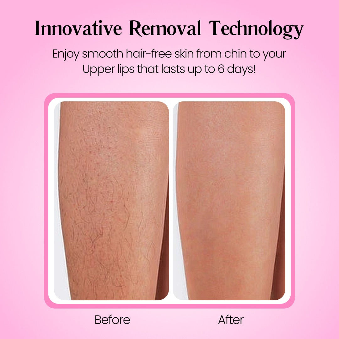 SmoothSkin Hair Removal Cream | Gentle 5-Minute Body Hair Removal
