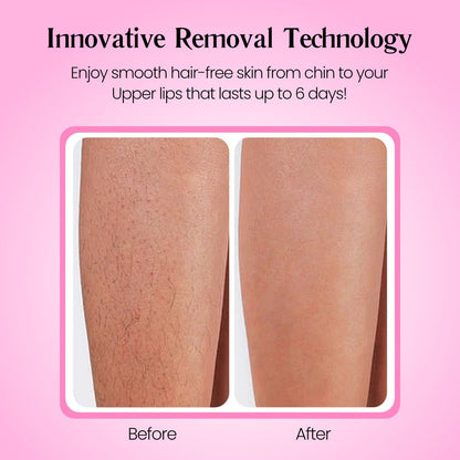 SmoothSkin Hair Removal Cream | Gentle 5-Minute Body Hair Removal